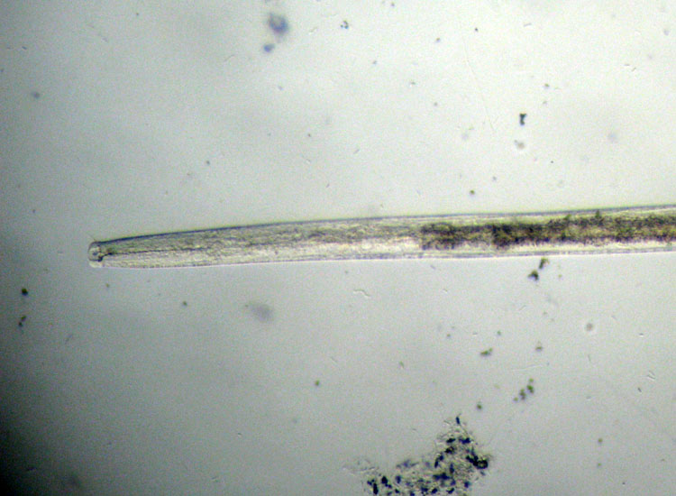 Microscopia delle spiagge adriatiche